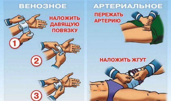 Что Делать Пострадавшему в ДТП если он в Больнице